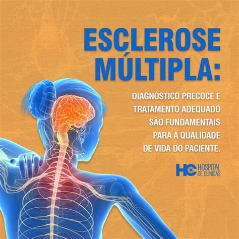 exame esclerose multipla